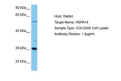 Western Blot: HSPA14 Antibody [NBP2-85081]