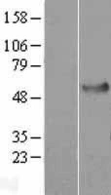 Western Blot: HSPA14 Overexpression Lysate [NBP2-07060]