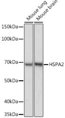 Western Blot: HSPA2 Antibody (5C9X0) [NBP3-16638]