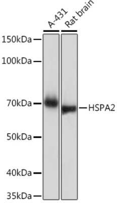 Western Blot: HSPA2 Antibody (5C9X0) [NBP3-16638]