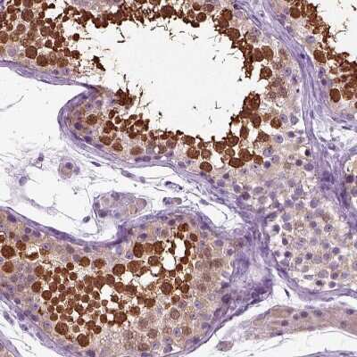 Immunohistochemistry-Paraffin: HSPA2 Antibody [NBP1-86185]