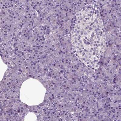 Immunohistochemistry-Paraffin: HSPA2 Antibody [NBP1-86185]