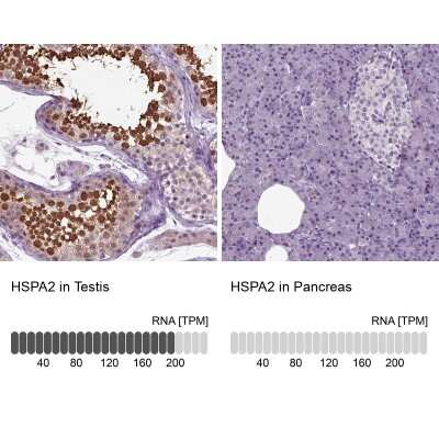 Immunohistochemistry-Paraffin: HSPA2 Antibody [NBP1-86185]