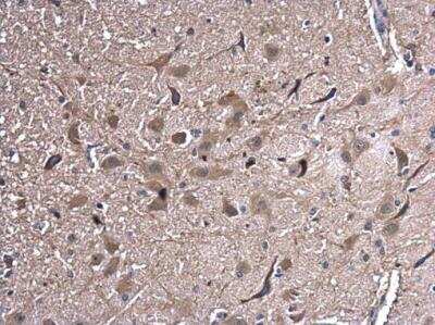 Immunohistochemistry-Paraffin: HSPA2 Antibody [NBP2-16897]