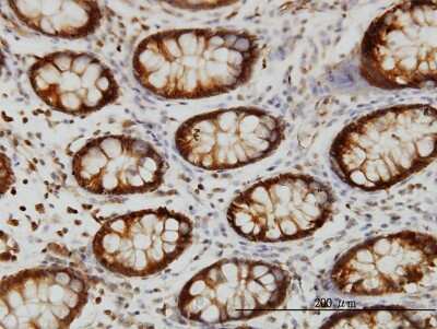 Immunohistochemistry-Paraffin: HSPA2 Antibody (S51) [H00003306-M06]