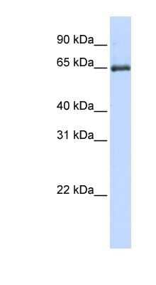 Western Blot: HSPA2 Antibody [NBP1-58213]