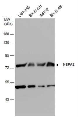 Western Blot: HSPA2 Antibody [NBP2-16897]