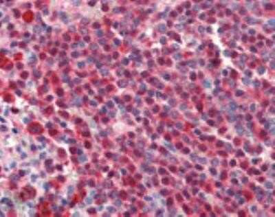 Immunohistochemistry-Paraffin: HSPA8/HSC71/Hsc70 Antibody (1B5) [NBP1-97868]