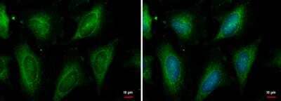 Immunocytochemistry/ Immunofluorescence: HSPA8/HSC71/Hsc70 Antibody [NBP2-16882]