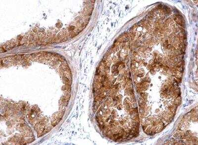 Immunohistochemistry-Paraffin: HSPA8/HSC71/Hsc70 Antibody [NBP2-16882]