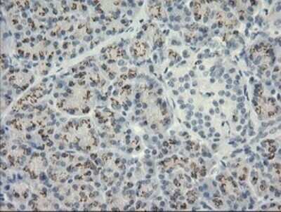 Immunohistochemistry: HSPA8/HSC71/Hsc70 Antibody (OTI1H3) - Azide and BSA Free [NBP2-70962]