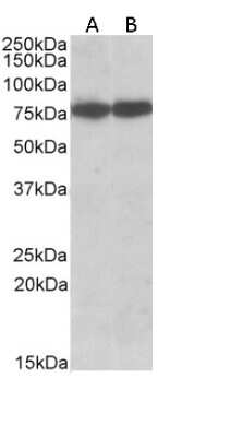 Western Blot: HSPA8/HSC71/Hsc70 Antibody [NB100-41377]