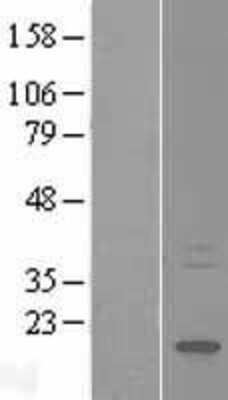 Western Blot: HSPB3 Overexpression Lysate [NBP2-07644]