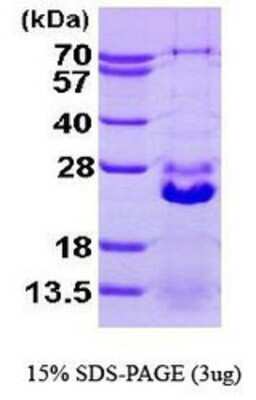 SDS-PAGE: Recombinant Human HspB7 His Protein [NBP1-41137]