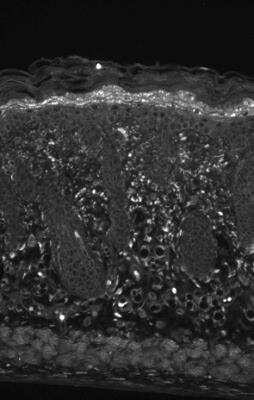 Immunohistochemistry-Paraffin: HSPB8/HSP22 Antibody (3C12-H11) [NBP1-48303]