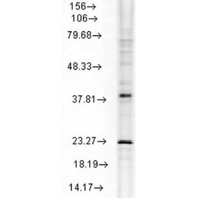 Western Blot: HSPB8/HSP22 Antibody (3C12-H11) [NBP1-48303]