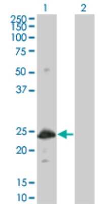 Western Blot: HSPB8/HSP22 Antibody (5C3) [H00026353-M03]