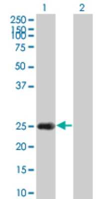 Western Blot: HSPB8/HSP22 Antibody (5D7) [H00026353-M02]