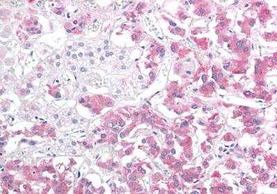Immunohistochemistry-Paraffin: HSPB8/HSP22 Antibody [NB100-1123]