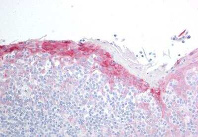 Immunohistochemistry-Paraffin: HSPB8/HSP22 Antibody [NB100-1123]