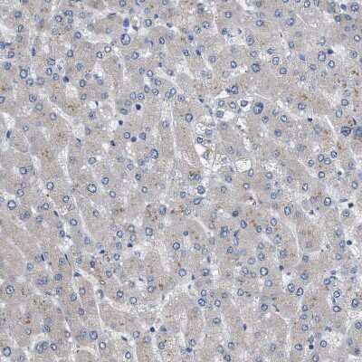 Immunohistochemistry-Paraffin: HSPB8/HSP22 Antibody [NBP1-84945]