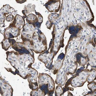 Immunohistochemistry-Paraffin: HSPB8/HSP22 Antibody [NBP1-84945]