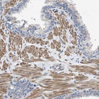 Immunohistochemistry-Paraffin: HSPB8/HSP22 Antibody [NBP1-84945]