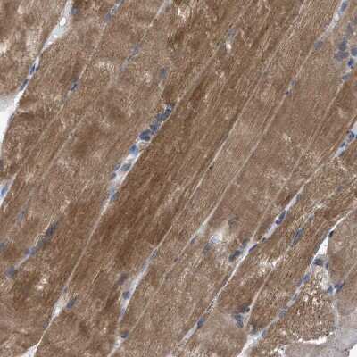 Immunohistochemistry-Paraffin: HSPB8/HSP22 Antibody [NBP1-84945]