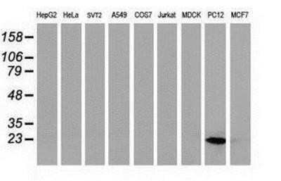 Western Blot: HSPB8/HSP22 Antibody (OTI1E3)Azide and BSA Free [NBP2-71828]