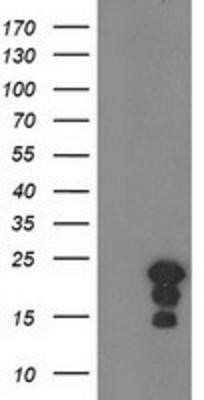 Western Blot: HSPB8/HSP22 Antibody (OTI1E3)Azide and BSA Free [NBP2-71828]