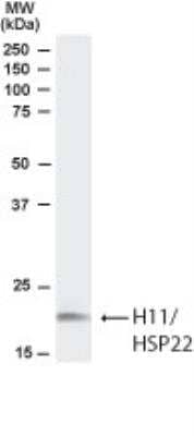 Western Blot: HSPB8/HSP22 Antibody [NB100-1123]