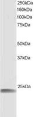 Western Blot: HSPB8/HSP22 Antibody [NB100-1123]