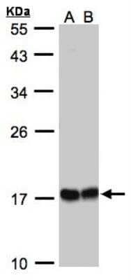 Western Blot: HSPB8/HSP22 Antibody [NBP1-30922]