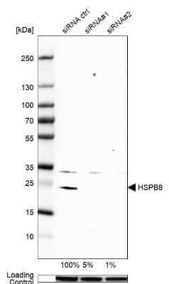 Western Blot: HSPB8/HSP22 Antibody [NBP1-84945]