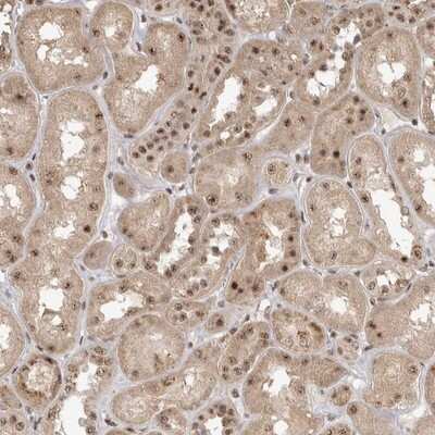 Immunohistochemistry-Paraffin: HSPC014 Antibody [NBP1-90734]