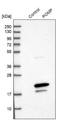 Western Blot: HSPC014 Antibody [NBP1-90734]