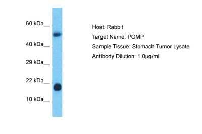 Western Blot: HSPC014 Antibody [NBP2-85083]