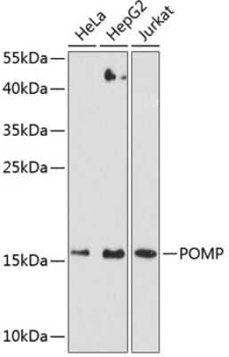 Western Blot: HSPC014 AntibodyAzide and BSA Free [NBP3-03274]