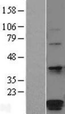 Western Blot: HSPC014 Overexpression Lysate [NBL1-14600]