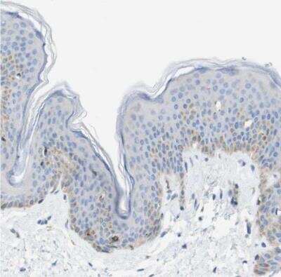 Immunohistochemistry-Paraffin: HSPC105 Antibody [NBP1-92015]