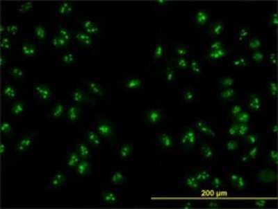 Immunocytochemistry/ Immunofluorescence: HSPC111 Antibody (1G4) [H00051491-M01]