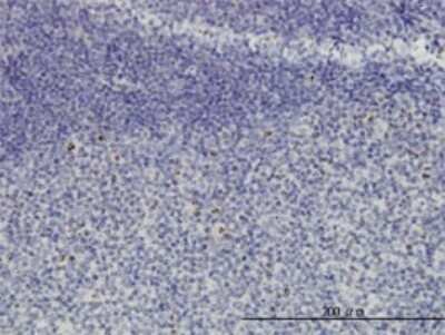 Immunohistochemistry-Paraffin: HSPC111 Antibody (1G4) [H00051491-M01]
