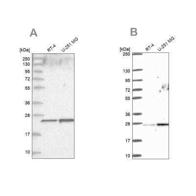 Western Blot: HSPC111 Antibody [NBP1-89659]