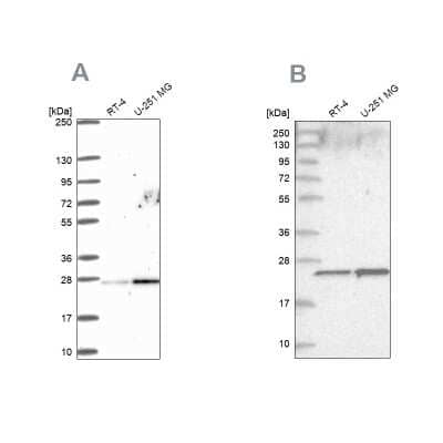 Western Blot: HSPC111 Antibody [NBP2-58774]