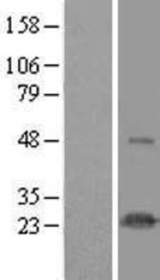 Western Blot: HSPC111 Overexpression Lysate [NBL1-11764]