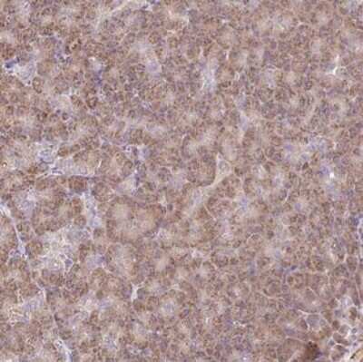 Immunohistochemistry-Paraffin: HSPC132 Antibody [NBP2-30707]