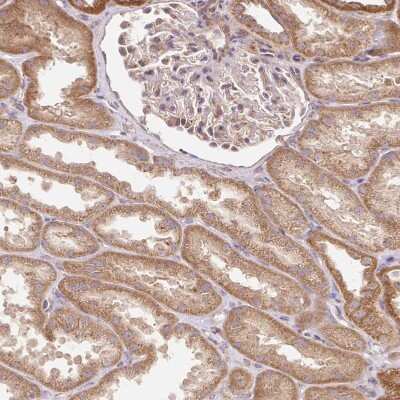 Immunohistochemistry-Paraffin: HSPC132 Antibody [NBP2-30707]