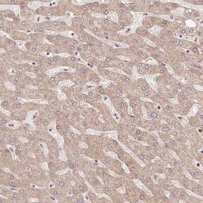 Immunohistochemistry-Paraffin: HSPC132 Antibody [NBP2-30707]