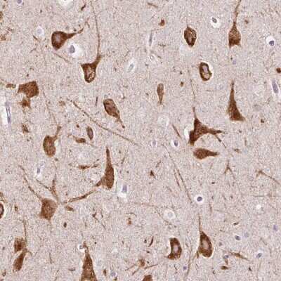 Immunohistochemistry: HSPC268 Antibody [NBP2-32036]