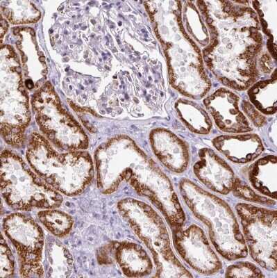 Immunohistochemistry-Paraffin: HSPC268 Antibody [NBP2-31902]